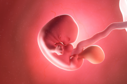 Dra. Thaline Neves explica como o diagnóstico precoce e o tratamento adequado da hidropsia fetal podem salvar vidas.